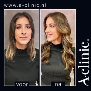 Haarverlenging met A-clinic Haarspecialist